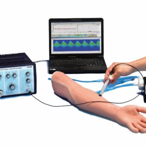 Doppler sonography